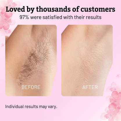 Alurevita Beauty Hair Reduction Oil – Stop Unwanted Hair & Reveal Softer Skin