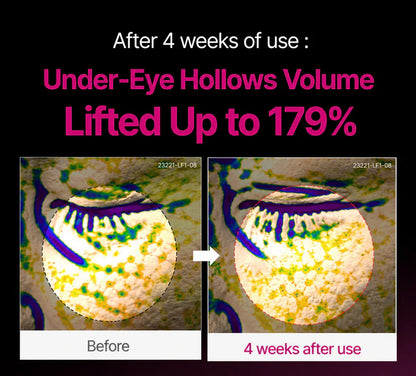 🔥LAST DAY 60% OFF!!AIUREVITA Korean Calcium Dark Spot Eye Cream